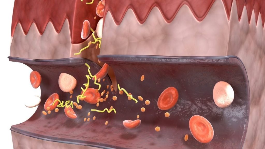 Dampak Diabetes Terhadap Kerusakan Pembuluh Darah Memahami Risiko Dan Strategi Pengelolaan