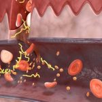 Dampak Diabetes Terhadap Kerusakan Pembuluh Darah Memahami Risiko Dan Strategi Pengelolaan